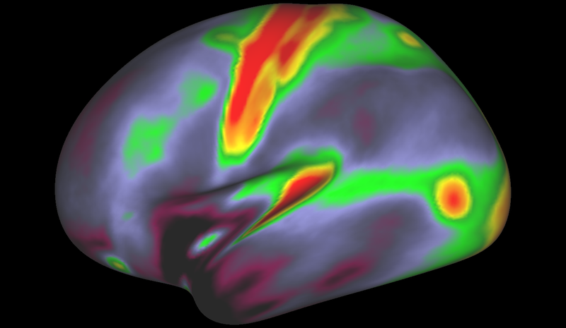 Brain scan showing a map of myelin content, a sheath that surrounds some nerve cells. (Image: Matthew F. Glasser, David C. Van Essen)
